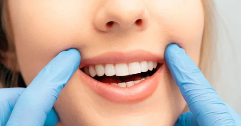 Dental C