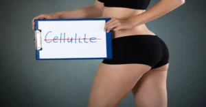 Cellulogia