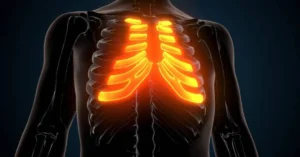 Rib Flare